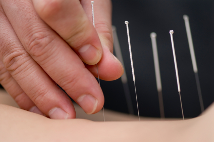 Acupuncture & Chinese Medicine